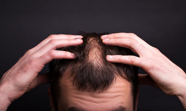 Tricopigmentation Hainaut, le centre agrée Dermo Hair à Charleroi et Namur